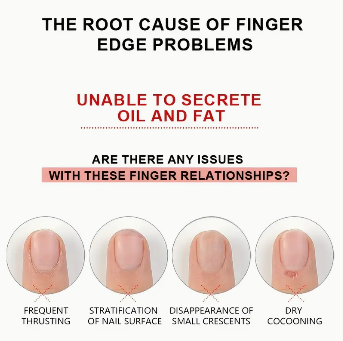 Cuticle Oil 10ml (Random Fragrance)